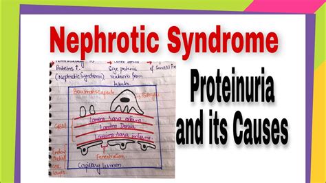 Nephrotic Syndromeproteinuria And Its Causesnephrology Lecture 7