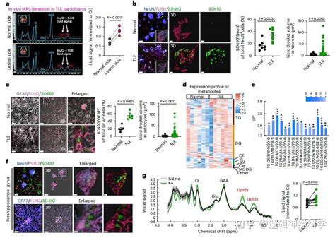 专家点评 Nat Neurosci︱突破！南京大学闫超团队揭示脂质堆积的反应性星形胶质细胞促进癫痫疾病进展 知乎