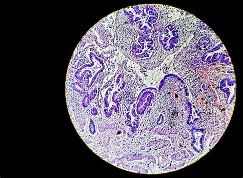 premium photo close microscopic view  histopathological stained