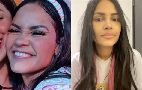 Flayslane Mostra Antes E Depois Da Rinoplastia Sem Curativo OFuxico