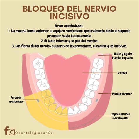 The Diagram Shows How To Use An Invisable Tooth For Dental Care And Hygiene