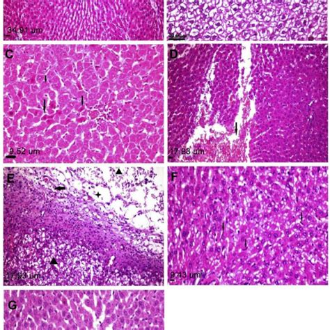 Histopathological Alterations In Splenic Sections Of Rats In Different Download Scientific