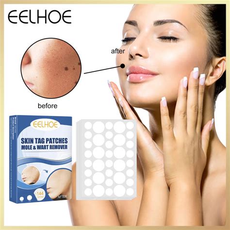 Eelhoe Skin Tag Patches Mole Wart Remover Gift Wart Treatment Liquid