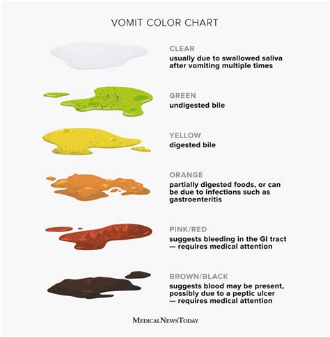 Vomit color chart: Clear, white, green, yellow, orange, red, and more in 2023 | Color, Green ...