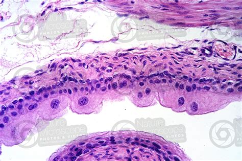 Rat Urinary Bladder Transverse Section X Rat Mammals