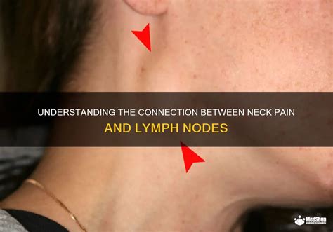 Understanding The Connection Between Neck Pain And Lymph Nodes Medshun