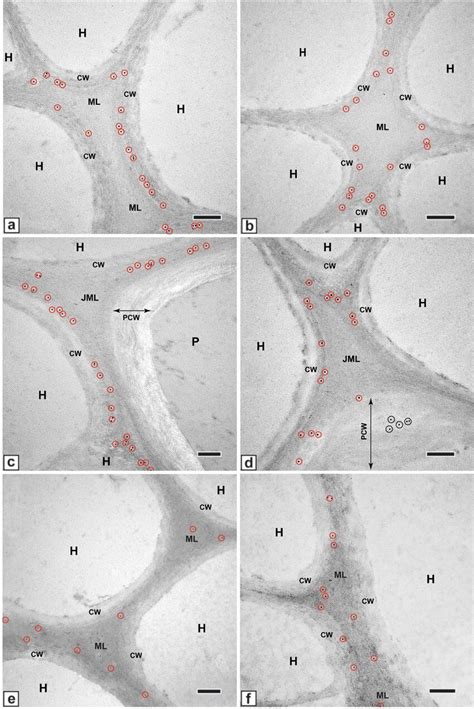 A F Tem Micrographs From Transverse Sections Of Hydroid Cells Showing