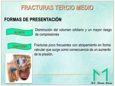 Fracturas Faciales Tercio Superior Y Medio Ppt