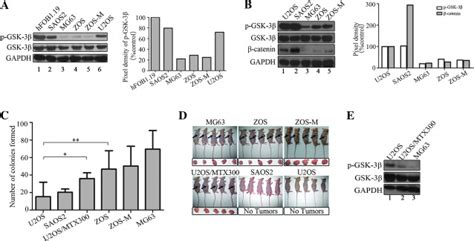 Glycogen Synthase Kinase 3β Nf κb Signaling And Tumorigenesis Of