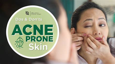 Dos And Donts For Acne Prone Skin Skin Care Tips To Control Acne And