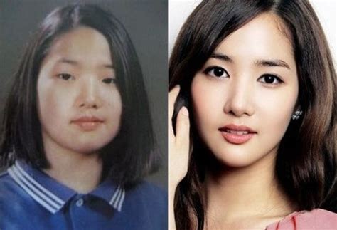 Park Min Young Before And After Plastic Surgery