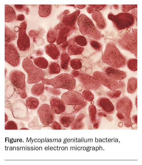 Mycoplasma Genitalium The State Of Play Medicine Today