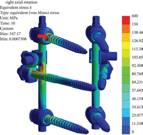 Von Mises Stresses Nephogram Of The Four Uniplanar Pedicle Screw Download Scientific Diagram