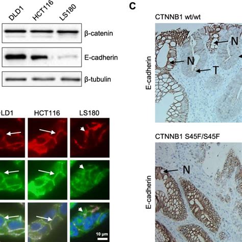 Comparison Of Mutated Ctnnb Allele Frequencies As Detected By Dna