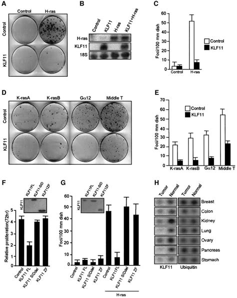 Klf11 Suppresses Oncogene Mediated Transformation In An Download Scientific Diagram