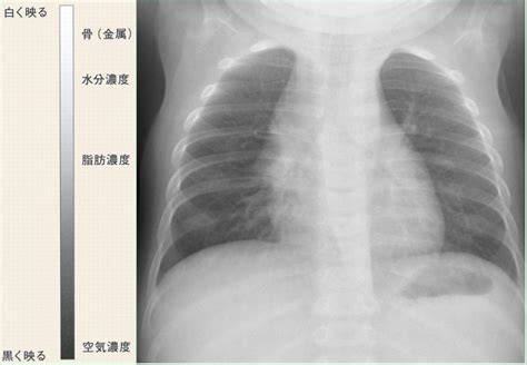 X線診断の基礎知識 レントゲン写真の読み方・簡単解説