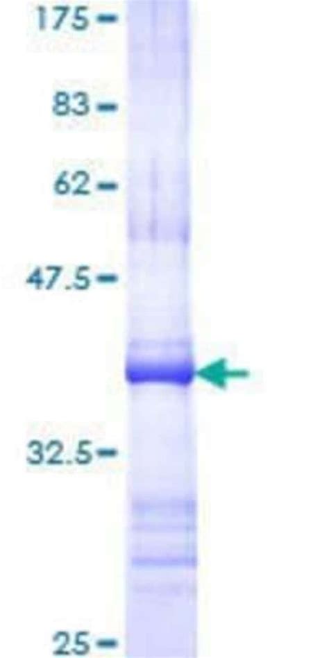 Novus Biologicals Recombinant Human Glycine Receptor Alpha 1 GST N