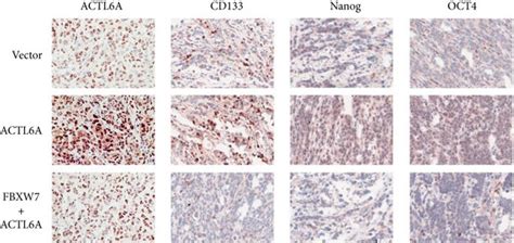 Fbxw7 Regulates Actl6a Expression Levels To Inhibit Hcc Growth In Vivo Download Scientific