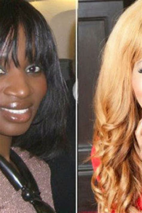 Skin Bleaching In Africa A Risky Addiction Daily Monitor