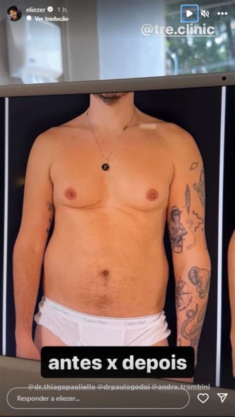 Eliezer Impressiona Ao Comparar Antes E Depois Do Corpo Ap S Cirurgias