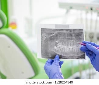 Periodontist Images Stock Photos Vectors Shutterstock