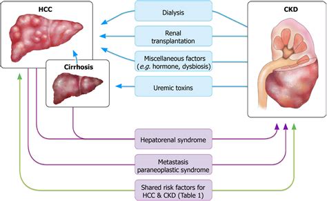 Hepatocellular Carcinoma Patient