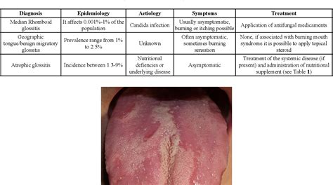 Median Rhomboid Glossitis Histology