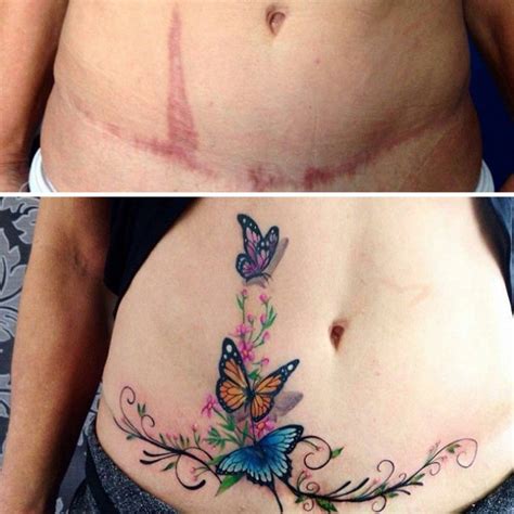 Tatuajes Para Tapar Cicatrices En El Abdomen Para Hombres Kulturaupice