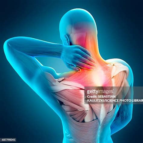 Neck Muscle Pain Illustration Photos and Premium High Res Pictures ...