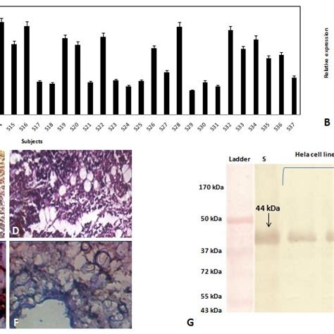 Comparing Mkn And Relevant Cd Gcscs Images Show Morphology Of