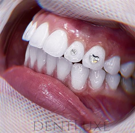 Swarovski Crystals Heart Tooth Gem Tooth Gem Diamond Teeth Dental Jewelry