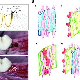 Overlaying Cell Sheets And Biomaterials To Mimic Multiple Periodontal