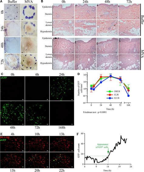 Dynamics Of Local Inflammation And Infection After Intradermal