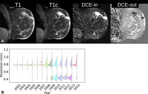 Radiologist Level Performance By Using Deep Learning For Segmentation