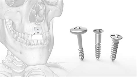 Osteomed Mincro Bone Graft Regeneration Fixation Kit Acumed