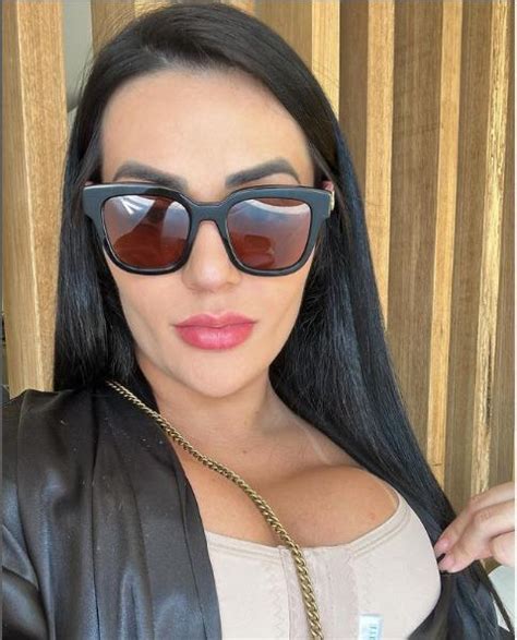 Influenciadora Carla Bora Enfrenta Complica Es Ap S Cirurgia E