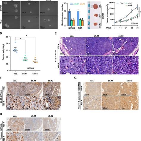 Alkal1 Silencing Inhibits Colorectal Cancer Cell Tumorigenesis A