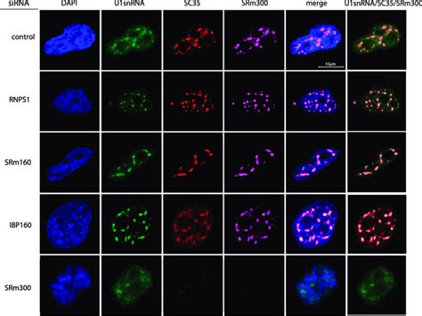 Subcellular localization of U1 snRNA in cells where the expression of ... 