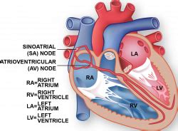 Conduction System | The Texas Heart Institute®