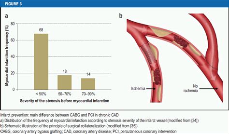 The Treatment Of Coronary Artery Disease 21 10 2022