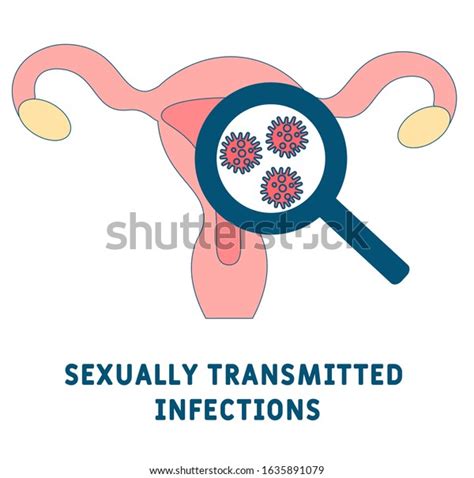 Sexually Transmitted Infections Concept Icon Stis Stock Vector Royalty Free 1635891079