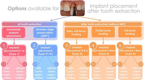 Management Of The Extraction Socket And Timing Of Implant Placement