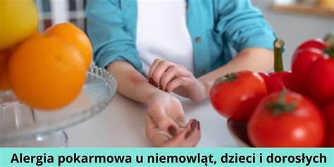 Alergia Pokarmowa U Niemowl T Dzieci I Doros Ych Objawy Leczenie