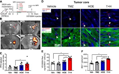 Pharmacological Inhibition Of Nhe In Combination With Tmz Increase