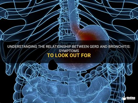 Understanding The Relationship Between Gerd And Bronchitis Symptoms To Look Out For Medshun