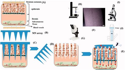 Microneedles Assisted Controlled And Improved Transdermal