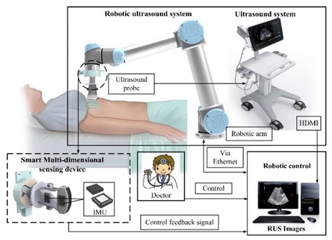 Sensors Free Full Text An Improved Sensing Method Of A Robotic