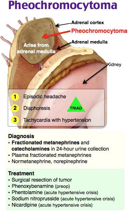 Pheochromocytoma Nurse Practitioner School Nursing Mnemonics Nursing Flashcards