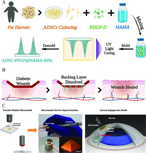 A Schematic Illustrations Of The Mns Loaded With Adscs And Pdgf D B