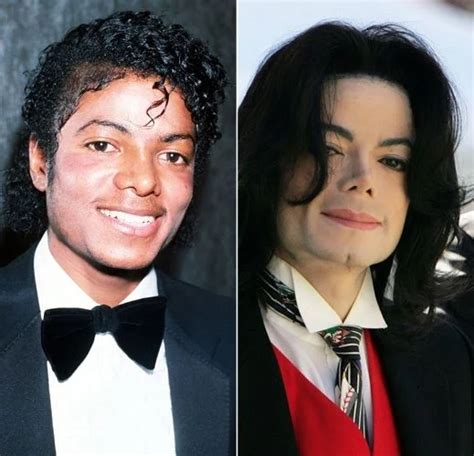 New: Michael Jackson Plastic Surgery Details - 2025